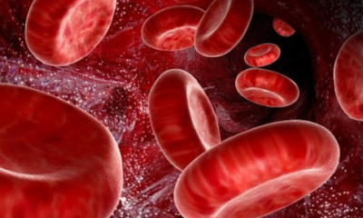 Understanding the Impact of Liver Disease on Red Blood Cells