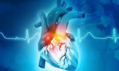 gastroenterologist in bangalore