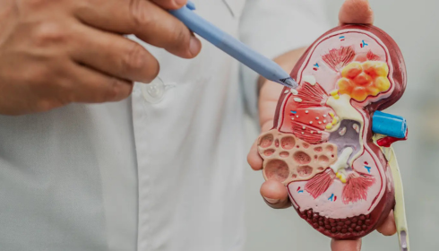 best nephrology hospital in hyderabad