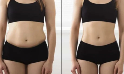 3D Liposuction In Bangalore