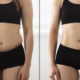 3D Liposuction In Bangalore