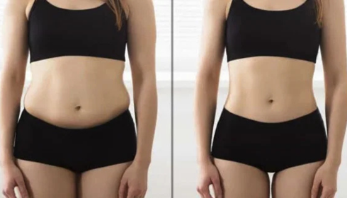 3D Liposuction In Bangalore