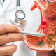 Gastroenterology Hospital In Bangalore