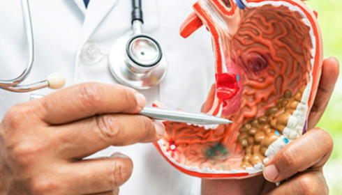 Gastroenterology Hospital In Bangalore