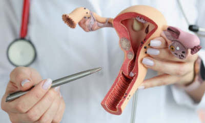 Cervical Cancer Survival Rates