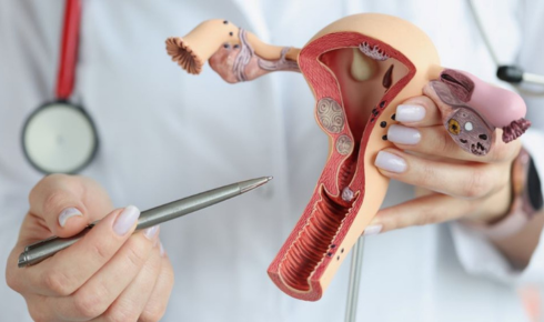 Cervical Cancer Survival Rates